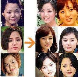 整容后遗症图片,美丽背后的风险与代价